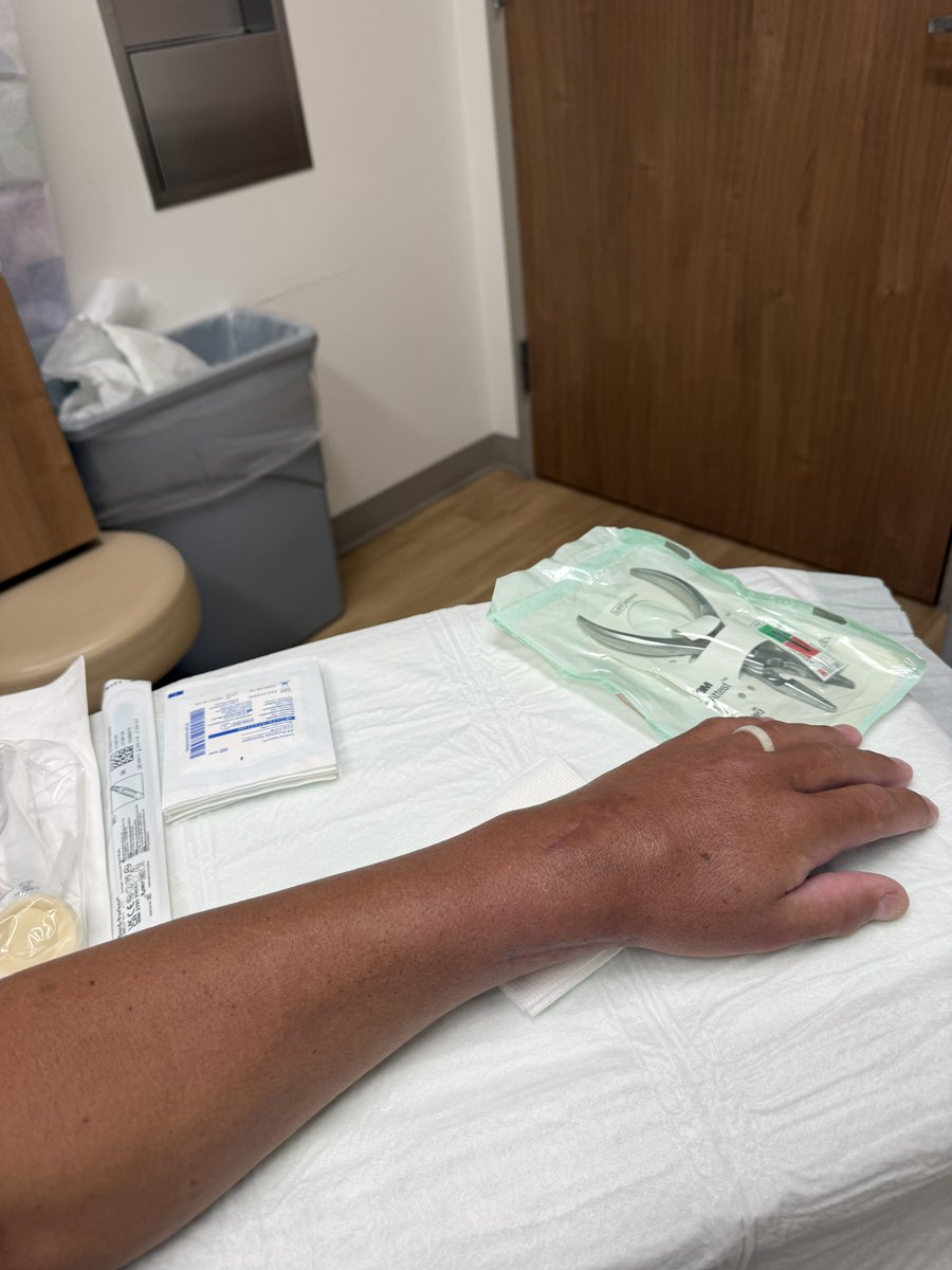 BobbySims13's tweet photo. One pin out today thing was causing issues almost poking through the skin. Now pizza time been too long https://t.co/uryGnD7vNF