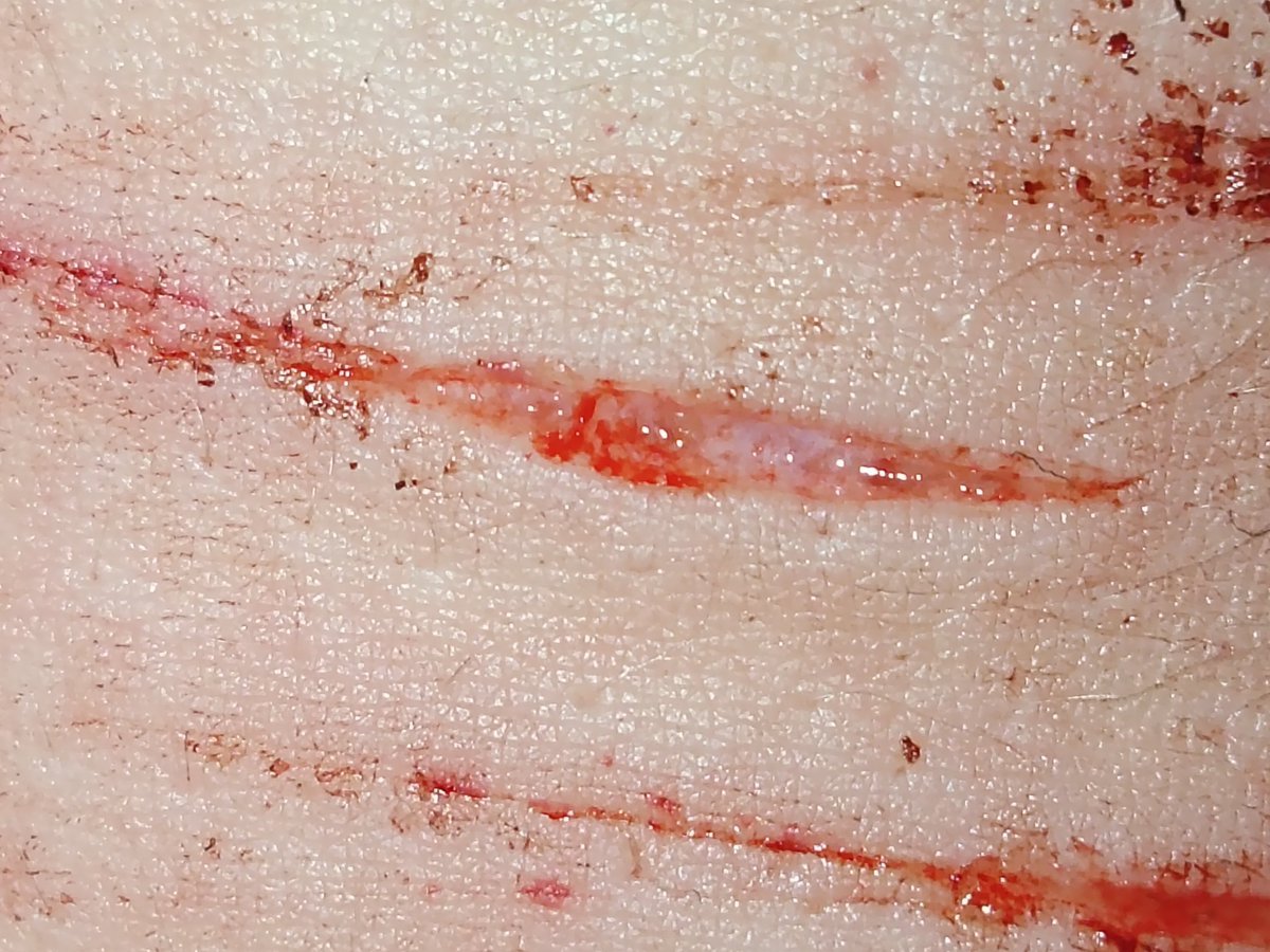 Keefkogane's tweet photo. Styro + I think deep styro??? Maybe like feetus beans but I  could just be delusional (#shedtwt #shtwt #slittwt)

All fake I pinky promise https://t.co/2kWVmmpR3K