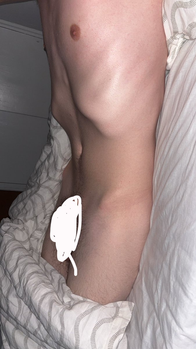 edshitidk's tweet photo. Ewŵŵ

#edtwt #bodycheck https://t.co/eStwYgi88E