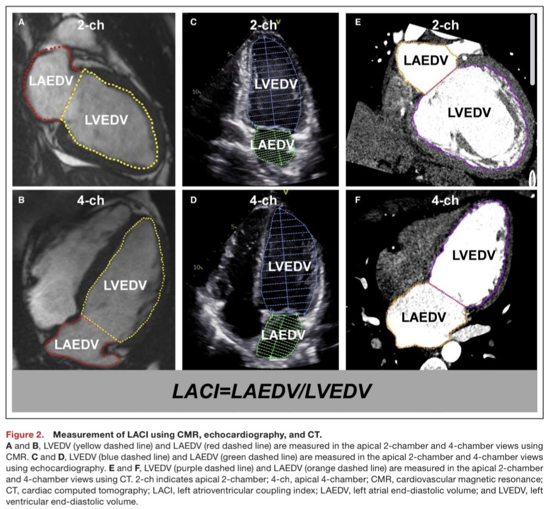 javier20ch's tweet photo. Eco🫀: Índice de Acoplamiento AuriculoVentricular izquierdo [LACI].
📊 El LACI es un parámetro ecocardiográfico que integra la relación funcional entre la aurícula izquierda y el ventrículo izquierdo en un solo índice. A diferencia de parámetros aislados como el LAVI o el E/e’, el LACI evalúa simultáneamente ambos compartimentos y su interacción mecánica durante la diástole.
🧮Fórmula = (Vol. TeleDiastólico de AI / Vol. TeleDiastólico del VI) x 100
🔷️Fisiopatológicamente, en la IC-FEVI preservada, el VI desarrolla alteración de la relajación y aumento de rigidez miocárdica. Esto incrementa las presiones de llenado, generando dilatación progresiva de la aurícula izquierda mientras el volumen ventricular permanece relativamente conservado. El resultado es un aumento del LACI, reflejando un desacoplamiento auriculoventricular. 🫀💢
🔷️En un estudio publicado en Scientific Reports 2025, los valores de LACI fueron significativamente mayores en IC-FEVIp (~59%) comparado con IC-FEVIr (~41%) y controles sanos (~13%). Un punto de corte >33% identificó IC-FEVIp con una S: 97% y E: 87%. 🧐🎯
🔷️Además de su utilidad diagnóstica en IC-FEVIp, el LACI se ha relacionado con riesgo de FA, severidad de disfunción diastólica, hospitalización por ICA y eventos CV adversos post-IAM, posicionándose como un biomarcador emergente de interacción auriculoventricular. 🔎❤️‍🩹

📄🆓️⤵️
DOI: 10.1161/JAHA.125.041392
https://t.co/TCbNlcenCf
https://t.co/ZvUEDdQlly
