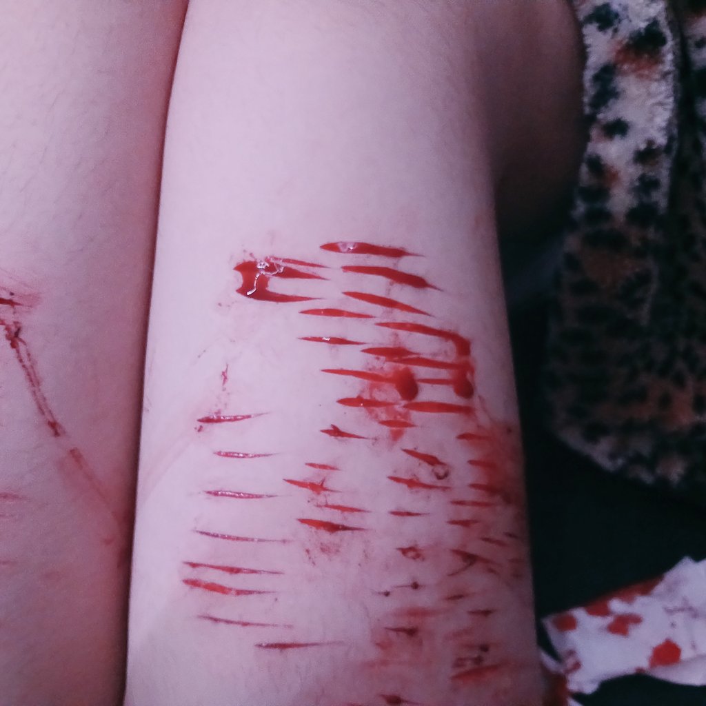 noanoway1's tweet photo. Are these baby beans?? What are those circles in my cuts #shtwt #slittwt (All fake sfx halloween makeup not real at all) https://t.co/5nv05aZaAl