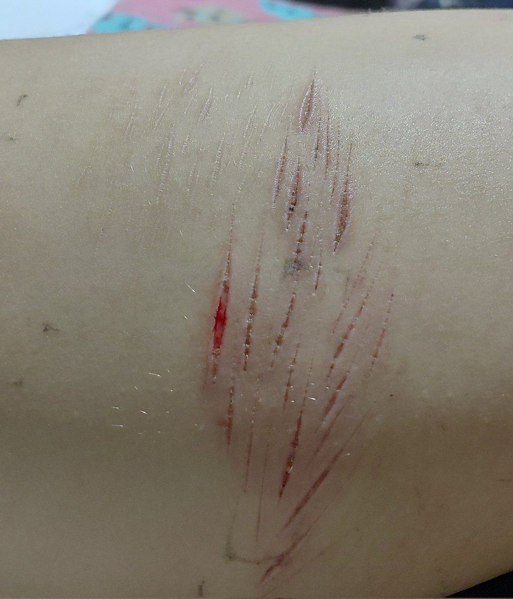 cuttingmycake's tweet photo. Leg scared again because 🤤🤤🤤 https://t.co/6PRYLmmVDf