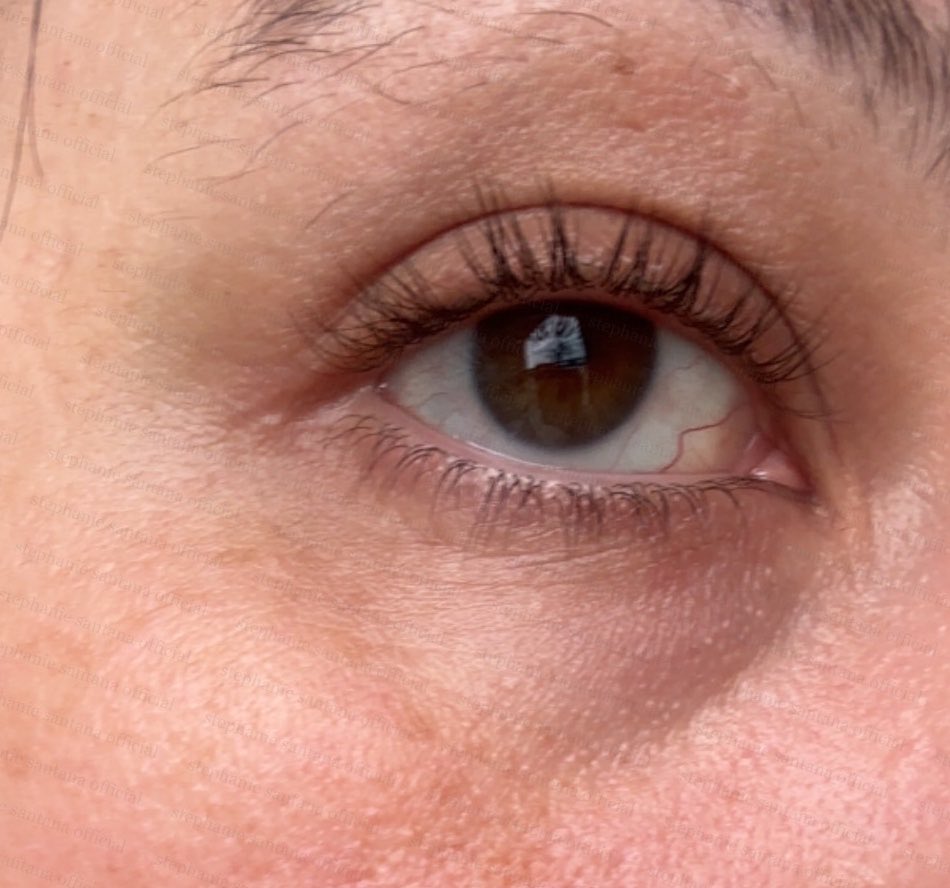 thestephsantana's tweet photo. Apparently, my left eye decided to host a private swelling party today and didn't invite the rest of my face. 🎈 Please send healing vibes (and advice on how to look human again). #SwollenEye #RoughDay https://t.co/2KH3GF8u5r