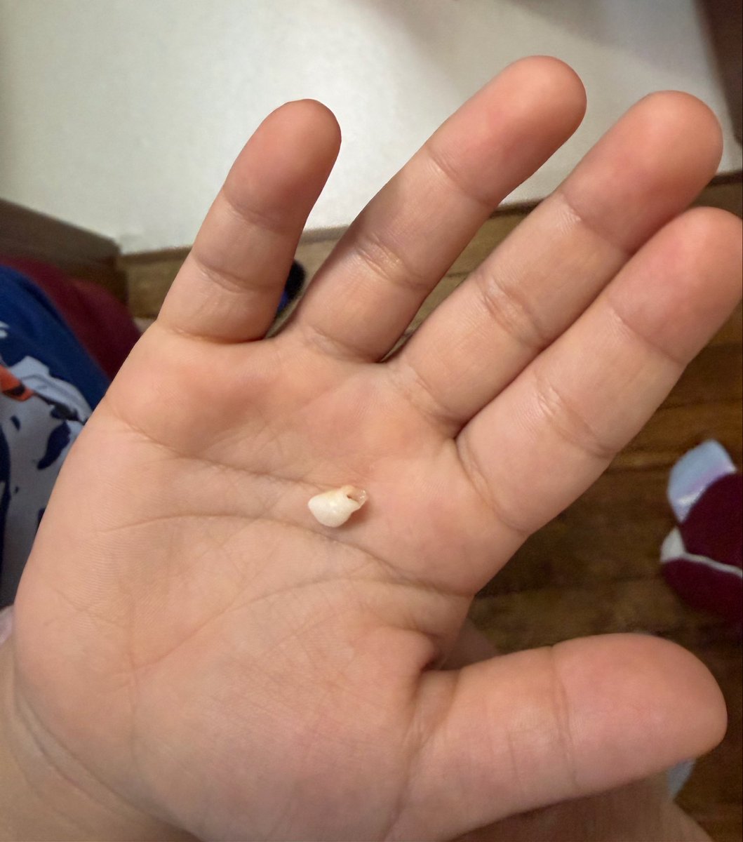 息子、3本目の歯が抜けました🦷