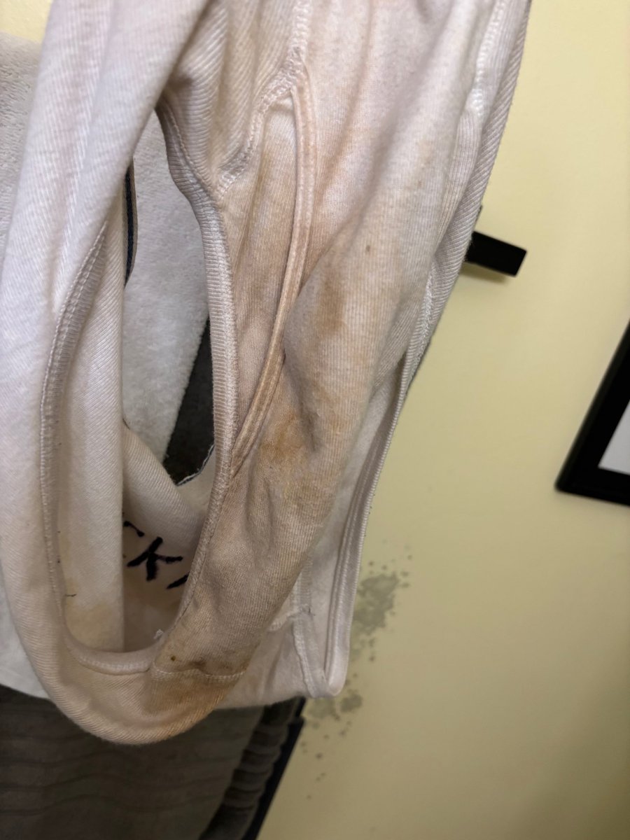 RomanCoques's tweet photo. It’s was a long time of wear and tear 🐷👃🏻 https://t.co/lSiq4r5yN9