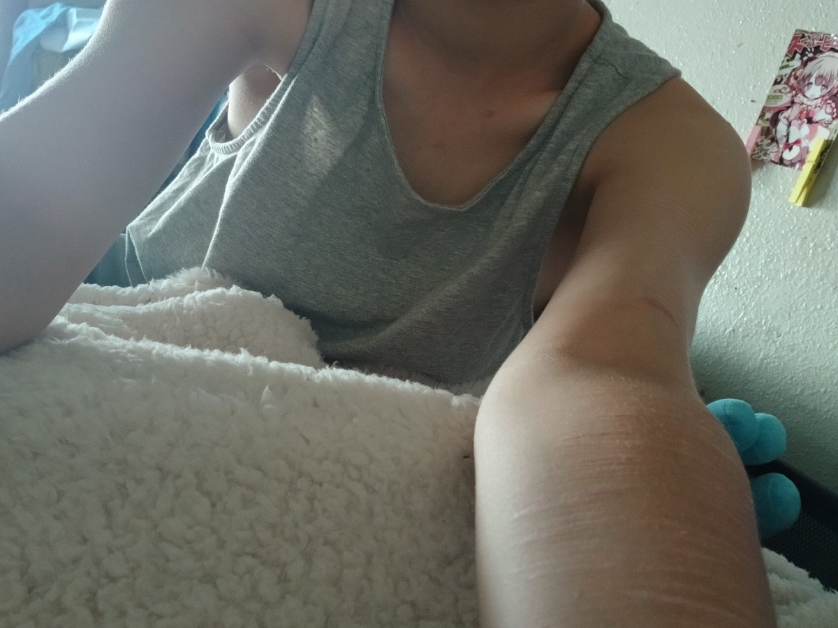 EY3CH3EWER's tweet photo. Photos because I'm kawaii and is too scared to be banned for cuts again ╥﹏╥ #bc #edtwt #bonespo #collarbones https://t.co/mwfE0RnAv1