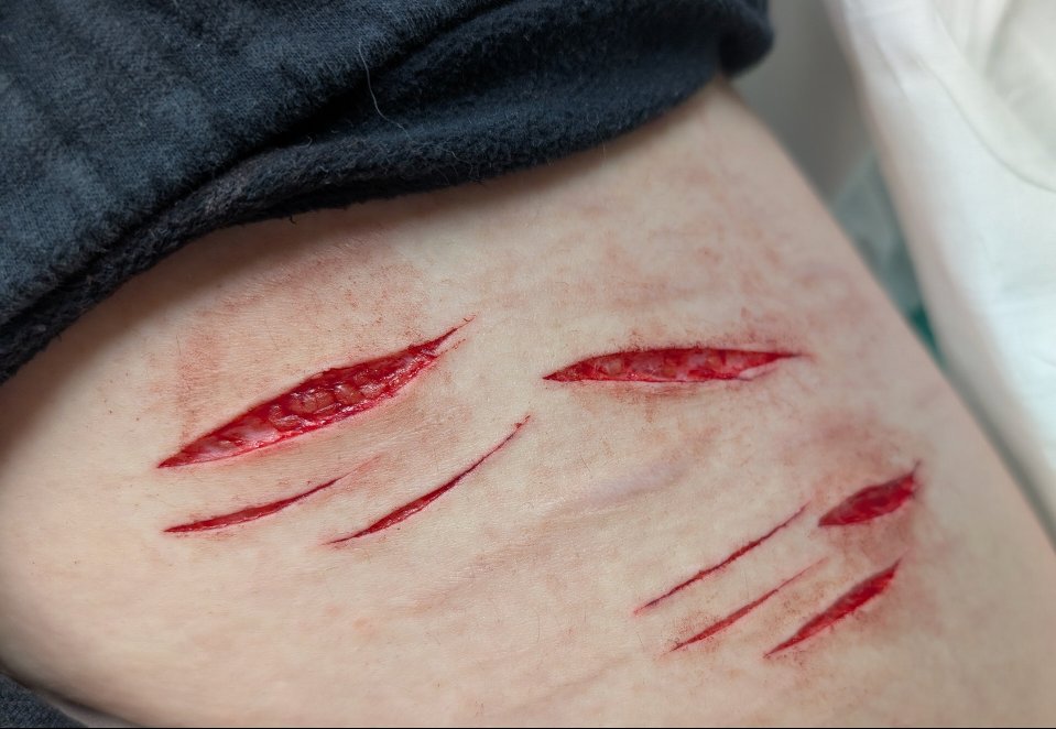 Meredith7069692's tweet photo. beans relapse, at the hospital getting stitches soon https://t.co/4yn3cvtmvB