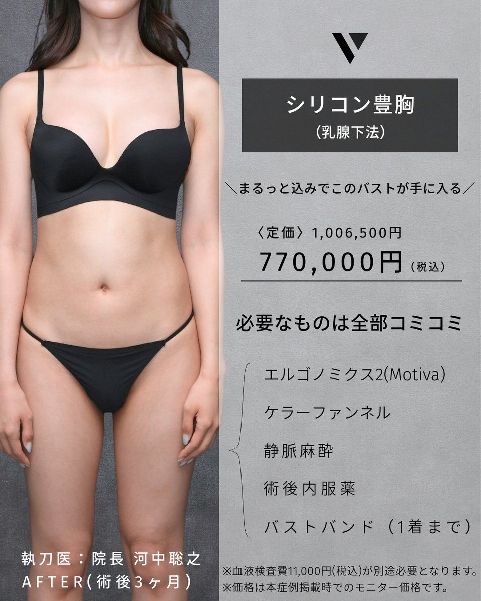 vertraclinic's tweet photo. 《 施術内容 》    
シリコン豊胸(乳腺下法)        

《 執刀医 》    
大阪院院長 河中 聡之(@Dr_kawanaka)       

 《 詳細 》    
男性/30代/161cm/47kg    
シリコンバッグ：motiva エルゴノミクス2    
シリコンサイズ：MINI 250cc    
挿入部位：脇下 https://t.co/3YLaf1cuFn