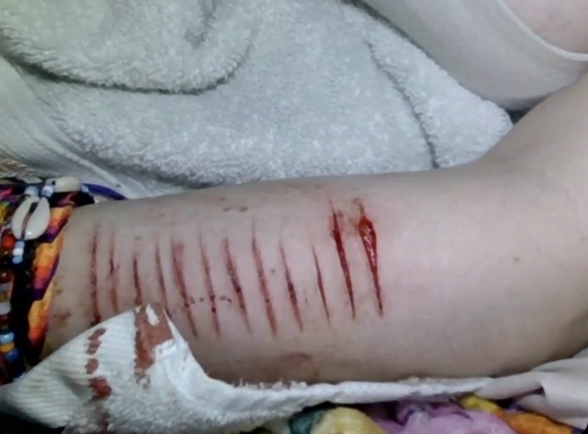 necrokitty420's tweet photo. fake blood fake cuts #slitwt #cutspo #beanspo #styrospo #styrotwt #shedtwt #shtwt #fakebody #seshy #drugtwt #bpdtwt #multiswipe #sledtwt
#shedbuildertwt
ft seshy w oomfie:3 @lesbianintow https://t.co/7HYNQmX80G
