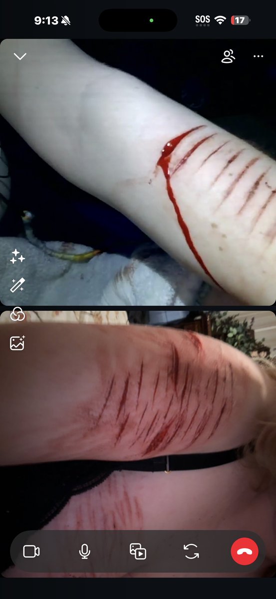 necrokitty420's tweet photo. fake blood fake cuts #slitwt #cutspo #beanspo #styrospo #styrotwt #shedtwt #shtwt #fakebody #seshy #drugtwt #bpdtwt #multiswipe #sledtwt
#shedbuildertwt
ft seshy w oomfie:3 @lesbianintow https://t.co/7HYNQmX80G