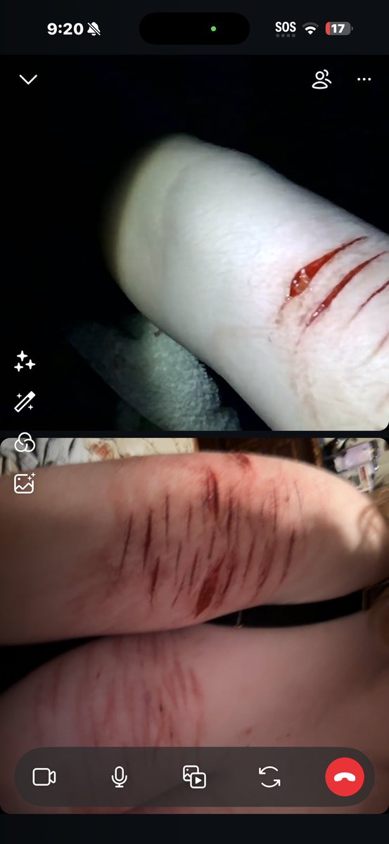 necrokitty420's tweet photo. fake blood fake cuts #slitwt #cutspo #beanspo #styrospo #styrotwt #shedtwt #shtwt #fakebody #seshy #drugtwt #bpdtwt #multiswipe #sledtwt
#shedbuildertwt
ft seshy w oomfie:3 @lesbianintow https://t.co/7HYNQmX80G