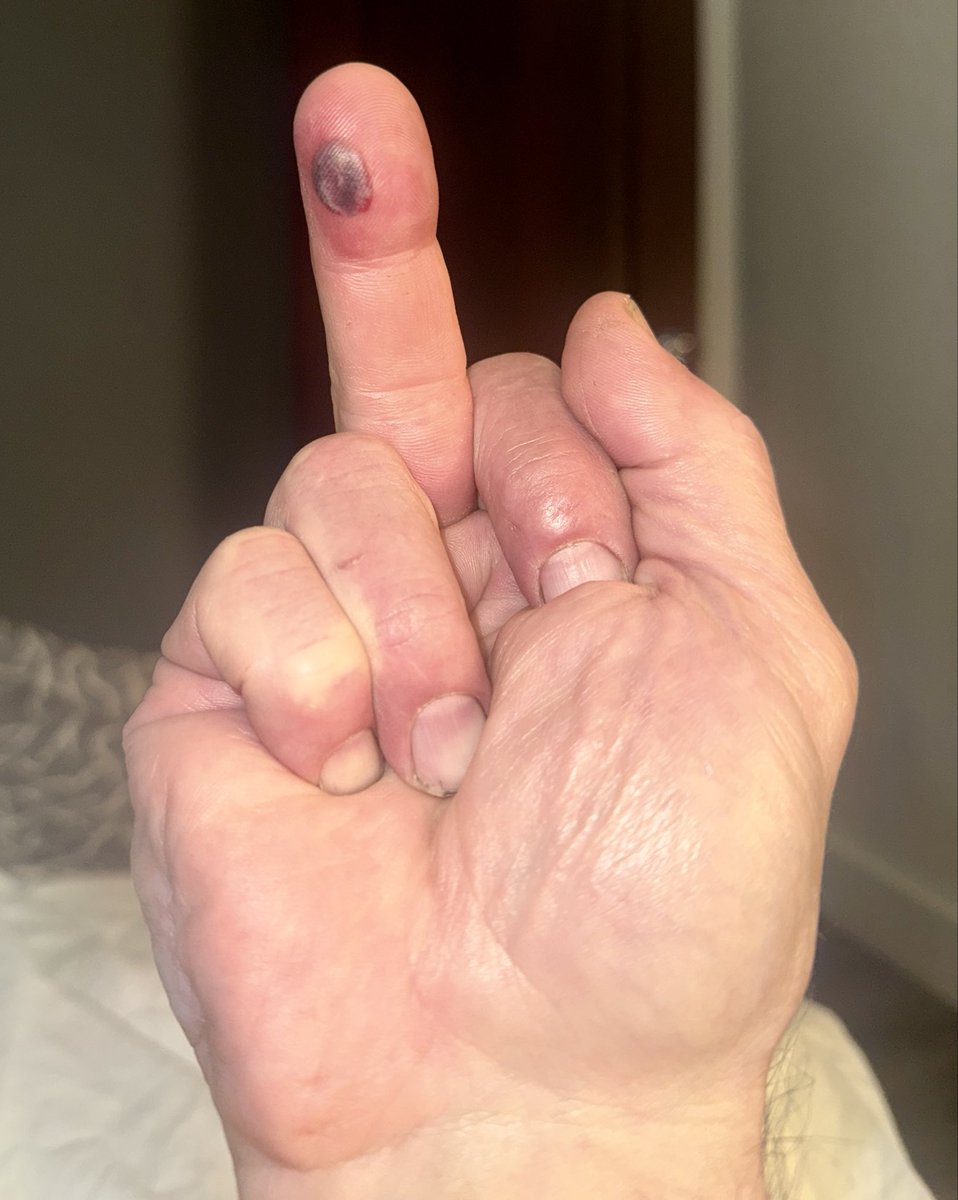 CoateDan's tweet photo. The possibilities are endless for the next few days! Hopefully you won’t be one who makes me show you my boo-boo! https://t.co/kQGt9I3aLU