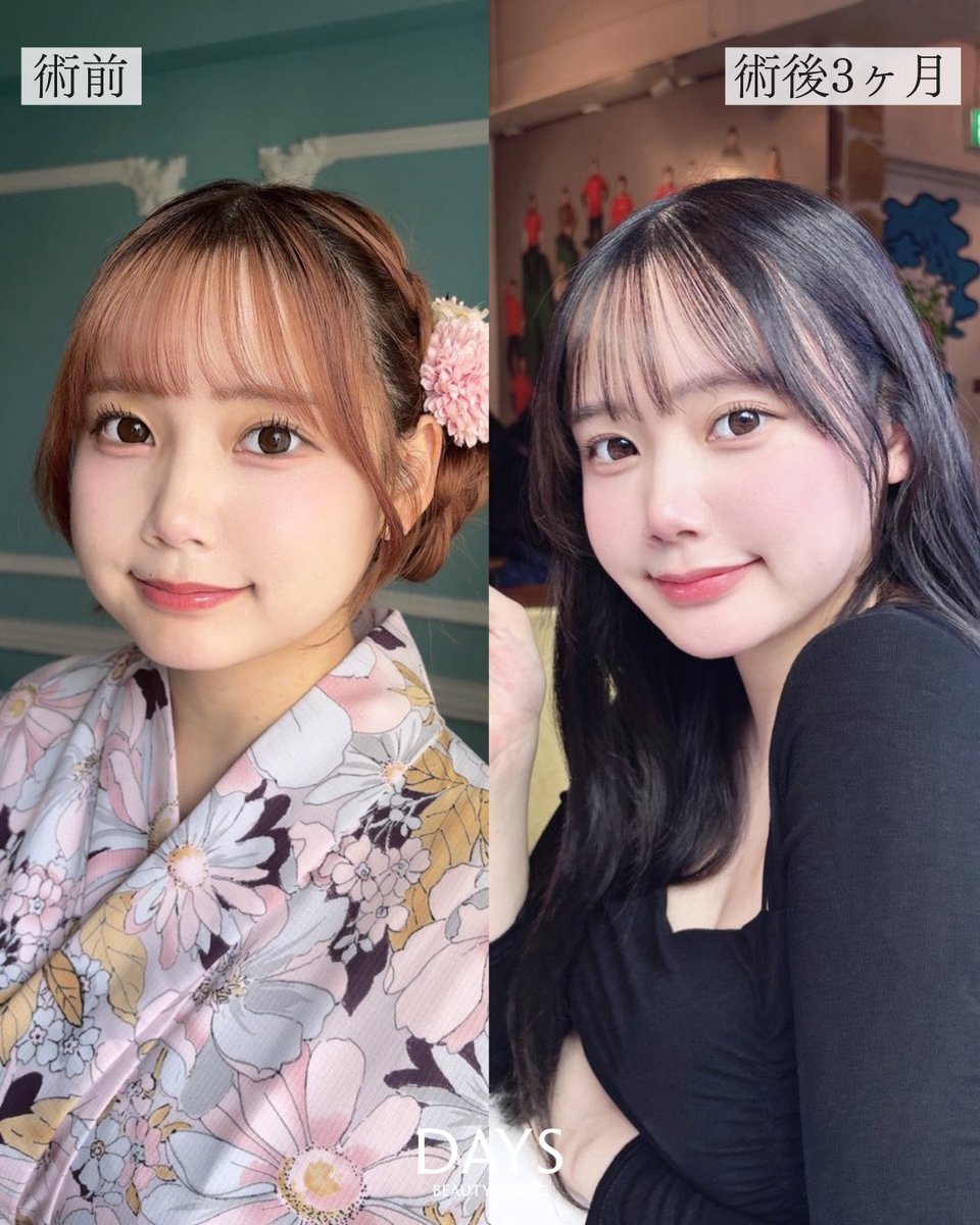 小顔整形 山野祐 tweet media