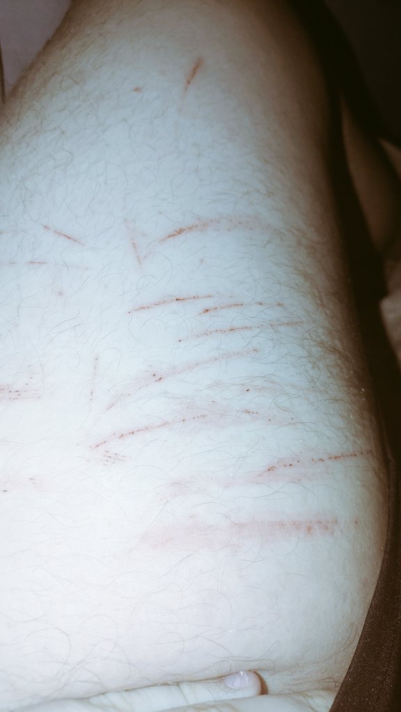 6_hoger's tweet photo. I'm disgusting and pathetic. https://t.co/q04Q3Sk7gr