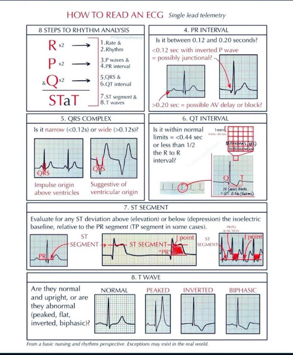Doctors__squad's tweet photo. HOW TO READ AN ECG 💥💥 https://t.co/H9gwyWtLZq