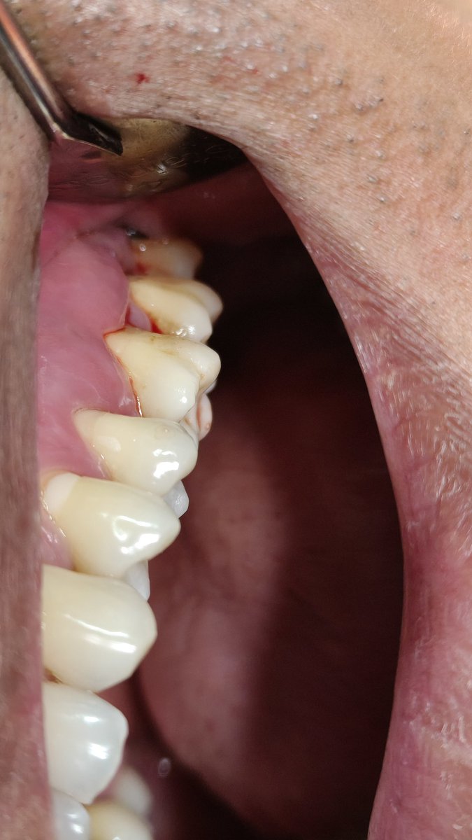 🦷Rakai🪥Virtual Dentist tweet media