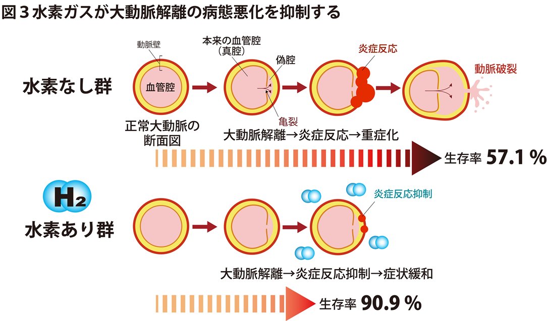 tmghig's tweet photo. ＜プレスリリース＞水素ガスが急性大動脈解離の重症化を抑制する―新たな治療戦略に期待―
急性大動脈解離モデル動物を用いて、水素ガス吸入が病態の悪化を抑え、死亡率や大動脈破裂を低下させることを明らかにしました。
詳細は以下URLよりご確認ください👇
https://t.co/CcbtHQU7YS https://t.co/yydsanSgLw