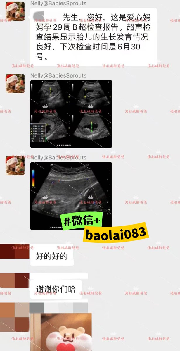 SarahStephk's tweet photo. 产检顺利通关✅ 哥伦比亚代孕妈妈现已孕29周，母婴状态都很不错
为了迎接这个小生命，奶爸和爷爷奶奶早早备好了各类用品，一家人还计划结伴前往波哥大，亲自迎接宝贝回家
本次移植一次就顺利好孕，格外圆满。👏

吉尔吉斯斯坦代孕 上海代孕 冻卵 洗精生子 #lesbisange 亲子鉴定 供卵 精子库 https://t.co/Dz7gfd2Z4j