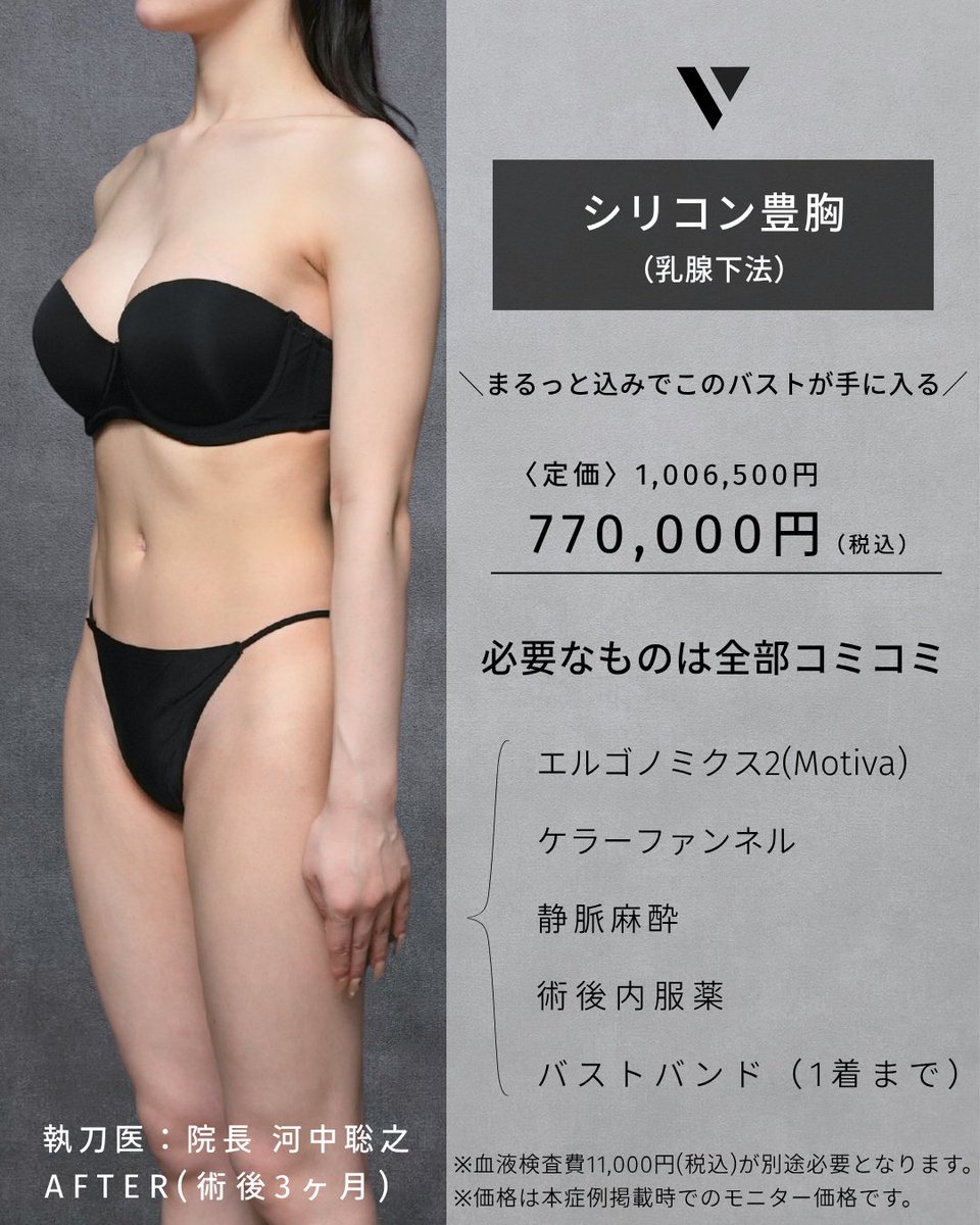 vertraclinic's tweet photo. 《 施術内容 》 
シリコン豊胸(乳腺下法)  

《 執刀医 》 
大阪院院長 河中 聡之(@Dr_kawanaka)  

《 詳細 》 
女性/20代/156cm/43kg 
シリコンバッグ：motiva エルゴノミクス2 
シリコンサイズ：DEMI285cc 
挿入部位：脇下 https://t.co/70REMTkX89