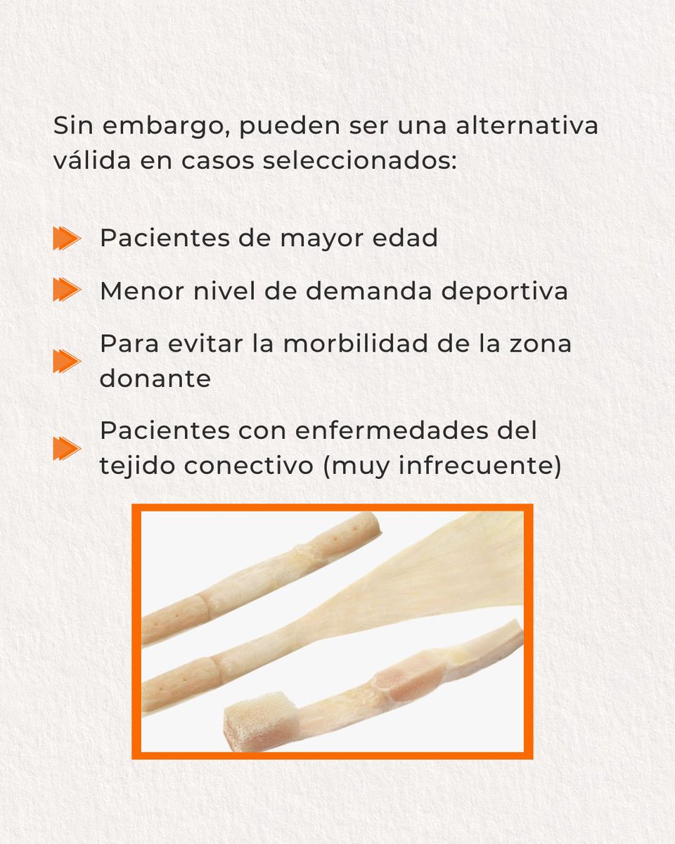 Knee_Spain's tweet photo. ¿Cuál es la mejor plastia para reconstruir un LCA? 🤔🦵

Desliza para entender cuándo podría ser mejor elegir un injerto u otro 👉 https://t.co/aEZtBXxWpa