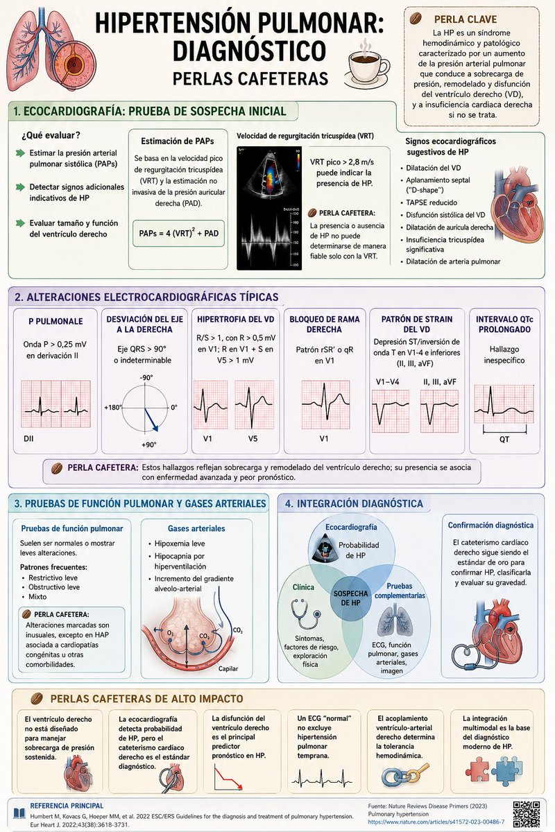 LeslieMegom's tweet photo. 👩🏻‍⚕️☕️Hoy vamos a hablar  de ...📈🫁Hipertensión pulmonar.
🔷️ La hipertensión pulmonar no es solo una enfermedad vascular pulmonar representa un síndrome de sobrecarga progresiva del ventrículo derecho (VD), cuya falla determina el pronóstico y mortalidad.
📜Notas cafeteras💎 ☕️
🔷️🫀 Ecocardiografía: herramienta inicial clave La sospecha de HP debe incluir: ▪️ Estimación de la presión arterial pulmonar sistólica (PAPs).
▪️ Evaluación estructural y funcional del VD.
▪️ Búsqueda de signos indirectos de sobrecarga derecha.
🔷️La HP lleva a una sobrecarga de la presión y a la disfunción del VD.
⏭️ante la sospecha de HP debe incluir la estimación de la presión arterial pulmonar sistólica (PAPs) y la detección de signos adicionales indicativos de HP.
💥🫁 La velocidad pico de regurgitación tricuspídea (VRT) es central:
Se calcula utilizando la ecuación de ▪️Bernoulli modificada: 
➡️PSAP=4x(VRT)² + PAD .
▪️Dónde:(VRT): Velocidad máxima del chorro de regurgitación tricuspídea (en metros/segundo, obtenida por Doppler continuo.
▪️4x(VRT)²  : Gradiente de presión entre el ventrículo derecho y la aurícula derecha.
▪️PAD: Presión de la aurícula derecha (en mmHg), estimada evaluando el diámetro y el colapso respiratorio de la vena cava inferior.
➡️Interpretación clínica de la VRT:
 ● <2.8 m/s: Probabilidad baja de hipertensión pulmonar.
●2.9 - 3.4 m/s: Probabilidad intermedia.
●>3.4m/s: Probabilidad alta.
☕️ Una VRT > 2.8 m/s aumenta la probabilidad de HP, pero: ❗️la presencia o ausencia de HP NO puede determinarse únicamente con este parámetro.
🔷️💥 Signos ecocardiográficos sugerentes de HP: ▪️ Dilatación del VD.
▪️ Aplanamiento septal (“D-shape”).
▪️ TAPSE reducido.
▪️ Disfunción sistólica del VD.
▪️ Dilatación de aurícula derecha.
▪️ Insuficiencia tricuspídea significativa.
▪️ Dilatación de arteria pulmonar.
🫁💥Alteraciones electrocardiográficas típicas.
• P pulmonale (P > 0,25 mV en la derivación II) 
• Desviación del eje a la derecha o sagital (eje QRS > 90° o indeterminable) • Hipertrofia del VD (R/S > 1, con R > 0,5 mV en V1; R en V1 + S en la derivación V5 > 1 mV) 
• Bloqueo de rama derecha completo o incompleto (patrón qR o rSR en V1) • Patrón de strain del VDa (depresión ST/inversión de la onda T en las derivaciones precordiales derechas V1-4 e inferiores II, III, aVF) 
• Intervalo QTc prolongado (inespecífico).
💥🫁La estimación de la PAPs se basa en la velocidad pico de regurgitación tricuspídea (VRT) y en el gradiente de presión derivado de la VRT después de descartar la estenosis pulmonar y teniendo en cuenta la estimación no invasiva de la presión auricular derecha (PAD).
⏭️Una VRT pico > 2,8 m/s puede indicar la presencia de HP, aunque la presencia o la ausencia de HP no se puede determinar de manera fiable solo con la VRT.
💥🫁Pruebas de función pulmonar y gases arteriales.
las pruebas de función pulmonar suelen ser normales o mostrar leves alteraciones restrictivas, obstructivas o combinados. Los trastornos más graves detectados en esta prueba se encuentran ocasionalmente en pacientes con HAP asociada a cardiopatías congénitas.
☕️🧠 Perlas cafeteras 💎
💎💥 El ventrículo derecho NO está diseñado para manejar sobrecarga de presión sostenida.
💎💥 La ecocardiografía detecta probabilidad de HP, pero el estándar diagnóstico sigue siendo el cateterismo cardíaco derecho.
💎💥 La disfunción del VD es el principal predictor pronóstico en HP.
💎💥 Un ECG “normal” NO excluye hipertensión pulmonar temprana.‼️
💎💥 El acoplamiento ventrículo-arterial derecho determina tolerancia hemodinámica y evolución clínica.📜
💎💥 La integración entre ecocardiografía, gases arteriales, función pulmonar y clínica sigue siendo la base diagnóstica moderna.
  👇👇👇👇👇
https://t.co/T5JXerMgZN
🔑🔓
https://t.co/pPJFPJe3JN