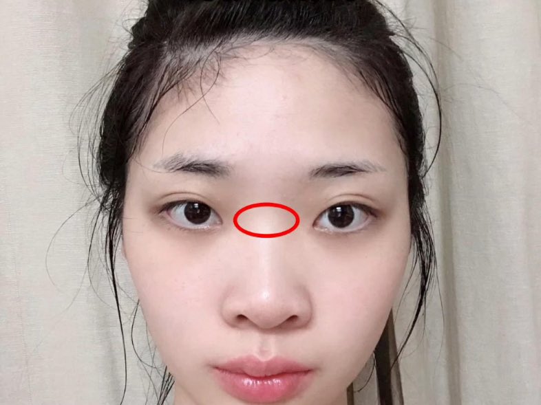 faliwubian002's tweet photo. 山根凹陷是床上的天才，很听话，奴性足。这种女人一般载事业上缺乏积极性，扛不住诱惑，但是奴性足，能满足男人的性幻想。按照命理学说是淫贱的命格。山根凹陷多淫不安于家室。因为欲望太强，自控力弱，而且普遍阴气过重，容易过度消耗男人的能量。#淫相学 #易学改变人生 开班授徒 https://t.co/DPJgOWNy0U