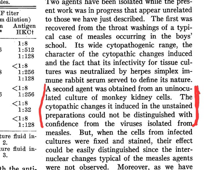 JamieAA_Again's tweet photo. 1954 John Enders developed what would become the Gold Standard for "Virus Isolation".  

Problem was in his own paper he inadvertently conducted a control with an Uninfected culture which in his own words produced CPE that could not be distinguished from the infected culture. https://t.co/WiPD8wwees