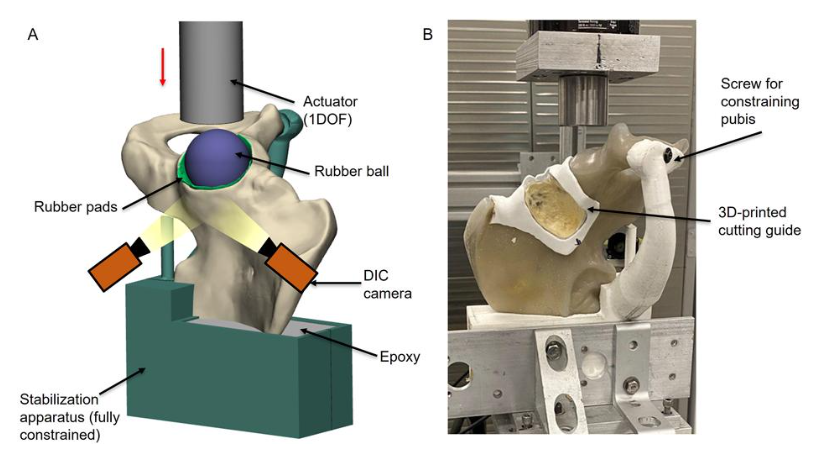 jbjs's tweet photo. "Biomechanical and Computational Modeling of Metastatic Acetabular Defects" by Doddridge et al.

Read the full article 👉 https://t.co/gVSsSZTYEE

#JBJS https://t.co/LBe71SlZ5A
