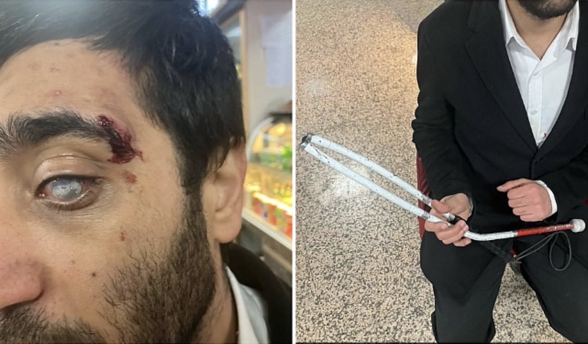 brezkazen's tweet photo. İmamoğlu’nun tutuklanmasının ardından gerçekleşen protestolarda Ankara’da  görme engelli bir yoldaşımız, polis tarafından bastonu kırdıktan sonra darp edilmişti. https://t.co/vbE68nj3nW