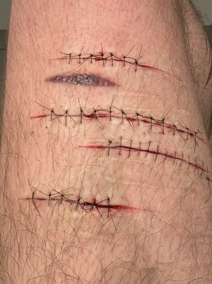 Butterssecret's tweet photo. Cuts from yesterday
#shtwt #beantwt #slittwt https://t.co/Spu5nf8RJz