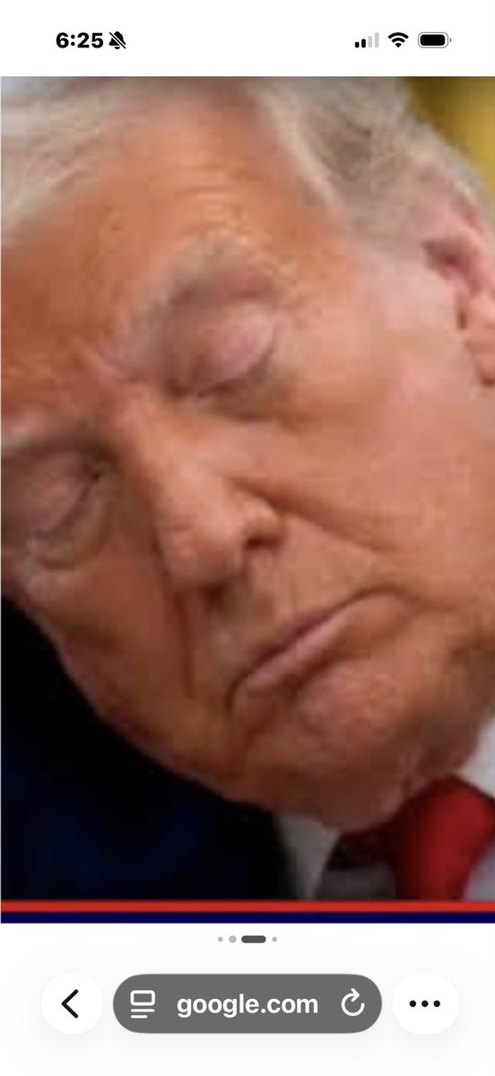 Cathy2NotToday's tweet photo. “Dr Reiner dismantled the official narrative by pointing out three distinct anomalies that the White House medical team has desperately tried to minimize.

🚩First is the severe, unexplained bruising on the president’s hands. While the White House communications team scrambled to attribute the deep discoloration to "vigorous handshaking," Dr. Reiner stated flatly that the explanation is ••medically impossible and insulting to basic human observation. 

🚩Second is the visible swelling of the ankles. The White House diagnosed the condition as chronic venous insufficiency, but Reiner noted a glaring internal contradiction: 🎇just one year ago, Trump’s official examination disclosed zero edema whatsoever. 

“Which would then make it ••acute venous insufficiency,” Reiner explained, “which is an entirely different thing.” Unlike a chronic condition that develops over decades, sudden acute edema acts as an immediate red flag for severe underlying pathologies, including congestive heart failure.✅✅✅🎯🎯( I see these signs as a repeat of my dad who died from CHF)

🚩Third, and perhaps most alarming, is the severe daytime somnolence. Dr. Reiner highlighted a documented pattern of the president repeatedly falling asleep in the Oval Office and the Cabinet Room while advisors are actively speaking to him. More critically, Reiner raised concerns that the commander-in-chief appeared to nod off during the solemn Memorial Day observances at Arlington National Cemetery just yesterday, on Monday. 

While expressing confidence that the medical team has conducted sleep tests for apnea, Reiner warned that chronic insomnia in an older patient is a severe clinical illness that accelerates cognitive decline, dementia, and cardiovascular failure…effectively adding three and a half years to a patient's biological age 

This was Trump’s fourth medical evaluation of his second term, revealing a frantic pace of examination that breaks completely with historical norms. While modern presidents typically visit Walter Reed once a year, Trump took two unannounced trips in 2025 alone…including an October visit initially cloaked as a routine MRI before later being exposed as a CT scan. 

This pattern of defensive, imprecise disclosure is exactly what Reiner has been warning the public about for months, telling the Washington Post that the administration exhibits a calculated and dangerous "lack of candor."

Reiner is now calling for mandatory, independent presidential health disclosures to Congress, noting that we require strict fitness-for-duty certifications for commercial pilots, Secret Service agents, and school bus drivers, yet allow the commander of the world's most powerful military to operate in a total medical vacuum. 

The president posted “PERFECT” and the White House promised “excellent overall health.” But the bruising is visible. The ankle swelling is visible. The daytime nodding off is visible. The American public is not required to choose an aggressive Truth Social post over the evidence of their own eyes. 

They are entitled to demand that the massive gap between propaganda and reality be explained by someone with medical credentials and zero allegiance to the man on the table. 

The chart says one thing. 

The body says another”

Excerpt from https://t.co/cg4XHAR0a9