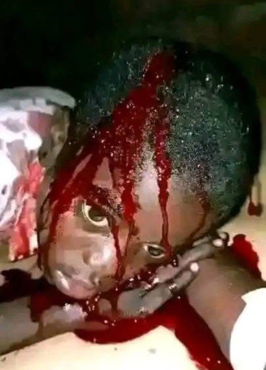 USBiafraFirst's tweet photo. The islamic terrorists continue intensify massacring innocent children with impunity 

The situation is getting worse, and lives are being lost while the country watches and media mute. 
We have really failed as humans watching this without rising up
No one is coming to save you https://t.co/qf6O5jCHMz