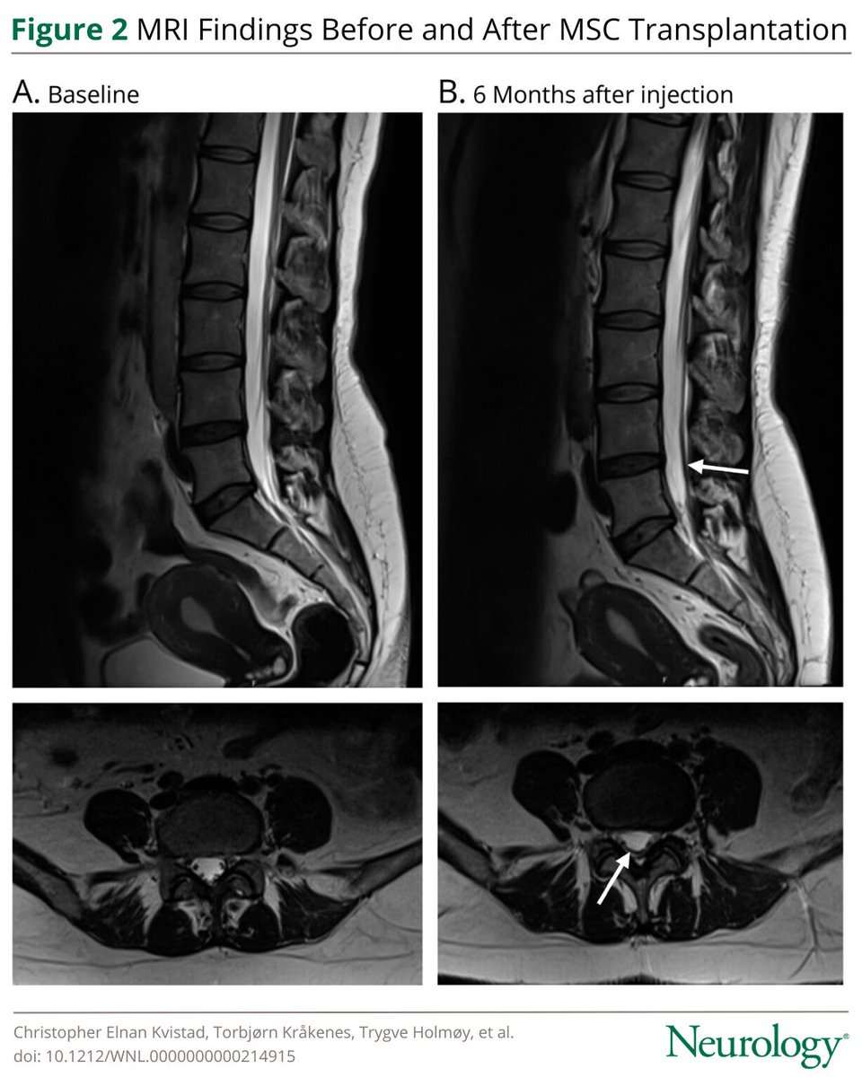 Neurology Journal tweet media