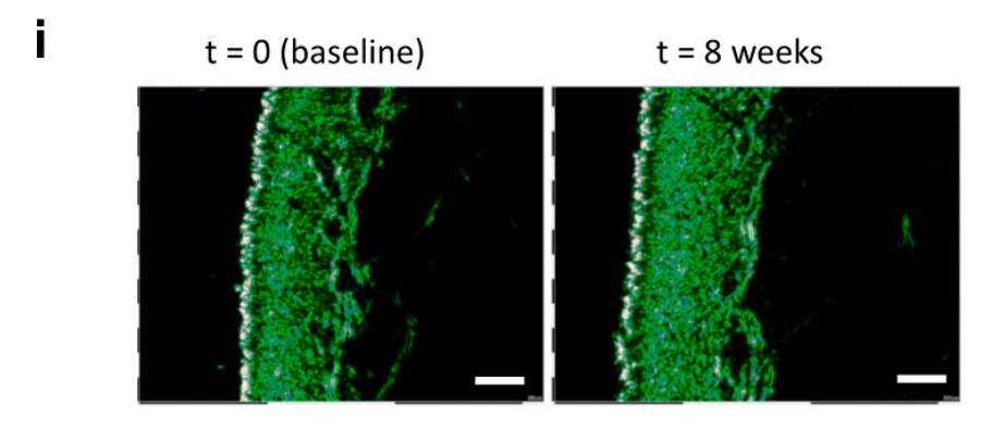 Outdoctrination's tweet photo. The kiwis increased skin density by ~50%.

The green here represents functional tissue, mainly collagen protein, in the skin.

After 8 weeks you can see a clear and robust increase. https://t.co/kD5zvDXasu