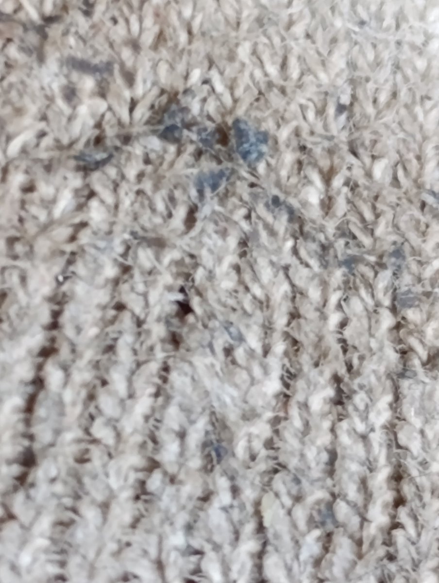 FemGoblinGTS's tweet photo. 3uropean h3atwave is sweat-melting my sock, and sweat smoothing the surface of my sole.

Weather like this is hell, but at least there is the aut0gynophilic enjoyment of my own stench. https://t.co/aS8JadHTHM