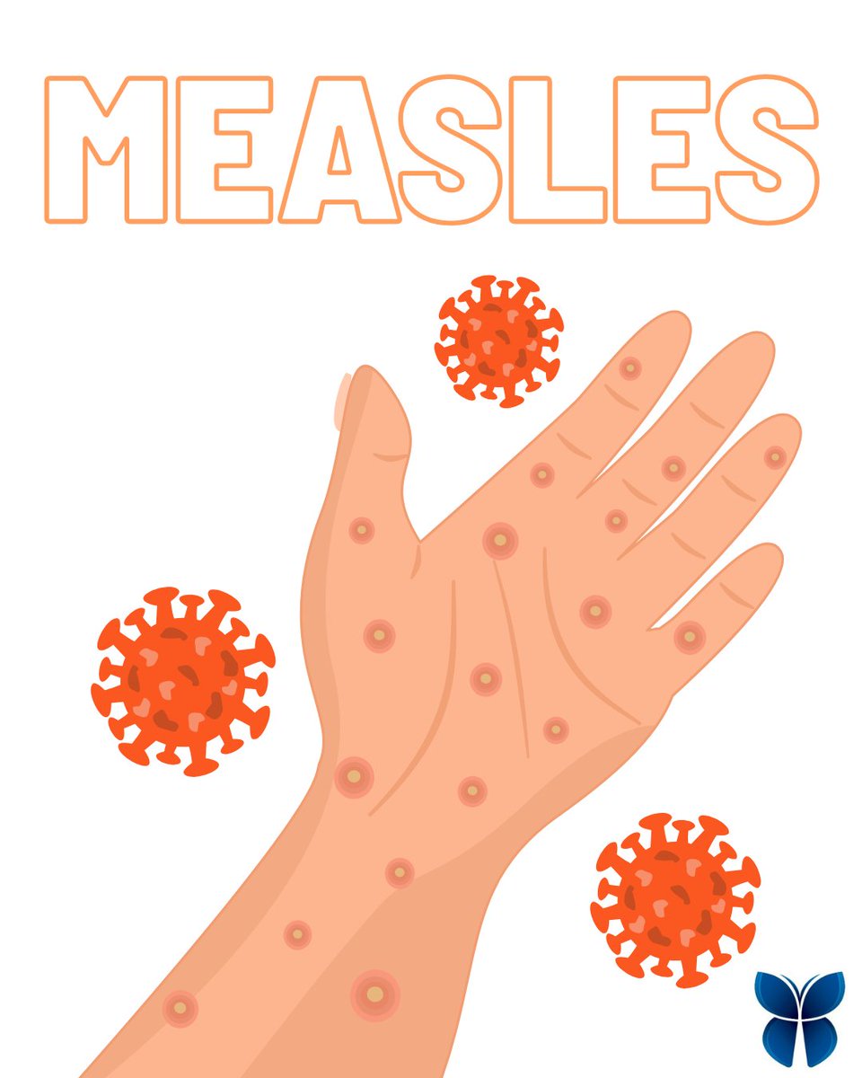 IPCWell's tweet photo. Are you monitoring measles activity in your state?

Measles cases continue across the U.S. Stay alert:
✔️ Follow state health updates
✔️ Review airborne precautions
✔️ Educate staff on symptoms

Learn more: https://t.co/lRfFf4D6DQ

#Measles #IP #LTC https://t.co/s5s9DSyyWK