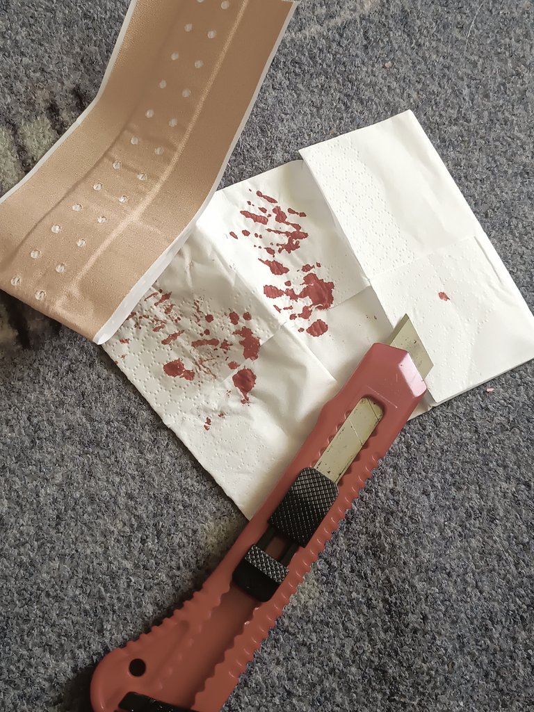 mattyb4ckup's tweet photo. new blade, styro with literally zero pressure lol
TW FAKE BLOOD TS IS FAKE https://t.co/6y9dvI52ed