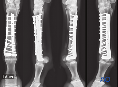 AOSurgery's tweet photo. Ready to deepen your knowledge of horse metacarpals/metatarsals treatments?🐎

Explore the comprehensive AO Surgery Reference module for in-depth guidance, complete with detailed illustrations and case examples. 

➡️ https://t.co/m0JcXeKGBA

#AOVET #AOSurgeryReference https://t.co/FNtp2GJnt6