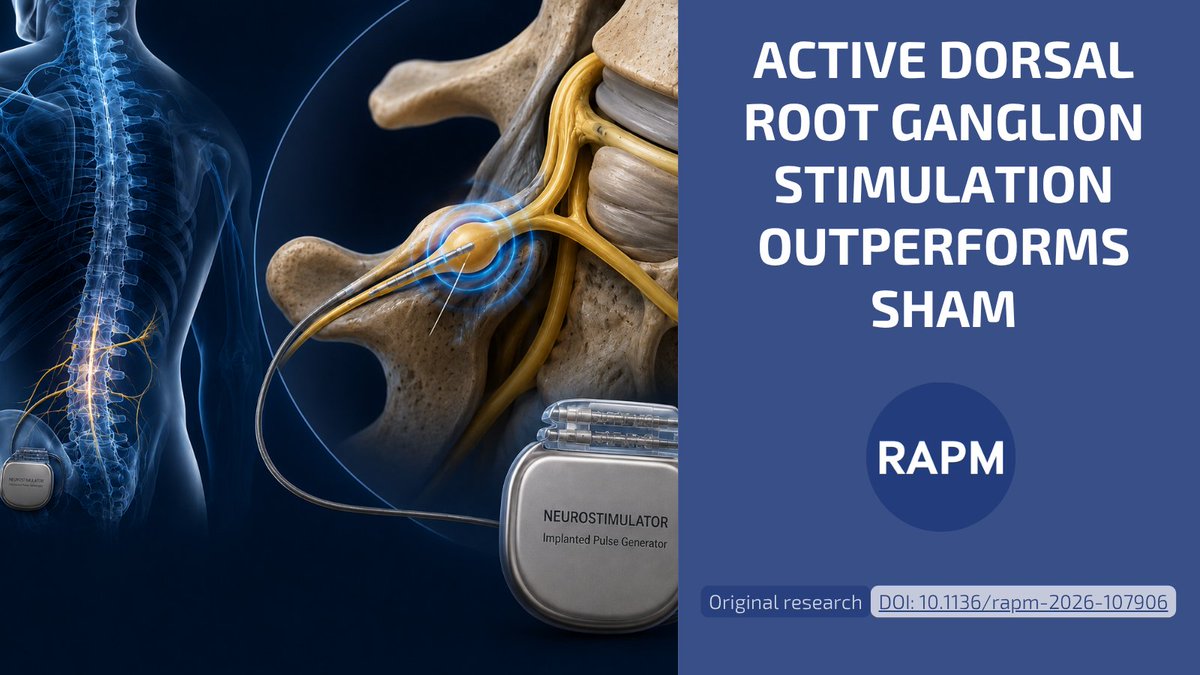 RAPMOnline's tweet photo. 🚨 Subperception DRG stimulation vs sham stimulation in established responders

An RCT found subperception DRG stimulation reduced pain vs sham in established responders, with no serious device-related adverse events. 

LINK -> https://t.co/UWXLwnjt8b

#RAPM #DRG #PainMedicine https://t.co/XuuzXO4NZf
