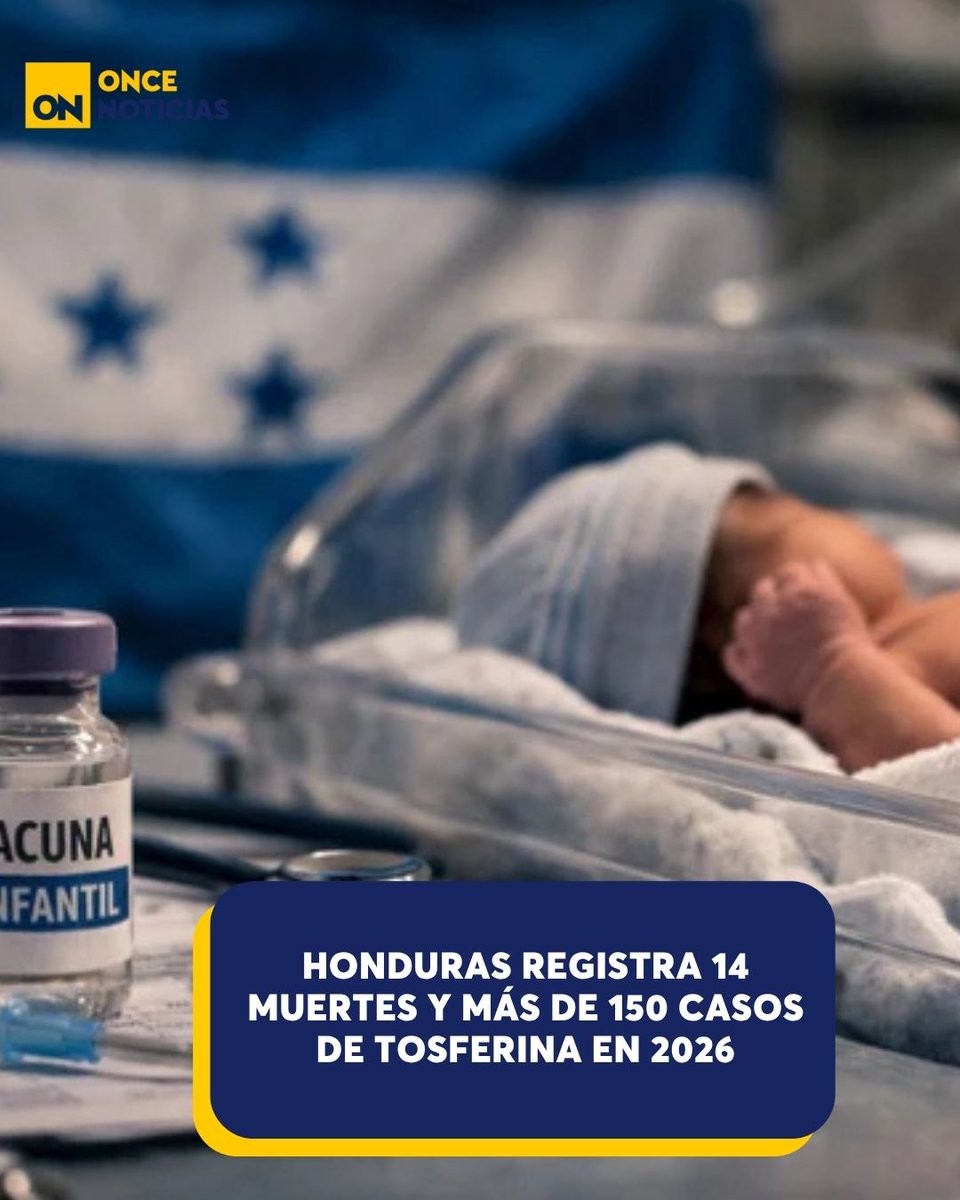 canal11hn's tweet photo. 🟡 | Autoridades sanitarias alertan por incremento de contagios de tosferina en el país
Detalles aquí👉 https://t.co/HPyYoIsVrn
#Honduras #Tosferina #Vacunas #Casos https://t.co/iyg1DOYf5D