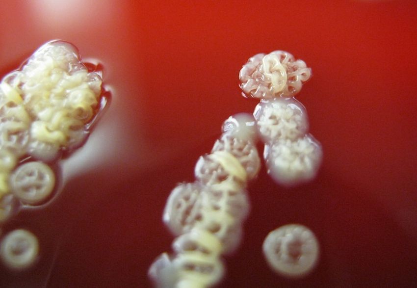 infosalut's tweet photo. #PublicaSalutIB 🧫🦠 @microHUSE ha participado en la Identificación y estudio funcional de nuevas bacteriocinas tipo cola de fago contra P. aeruginosa como antimicrobianos https://t.co/CpcZVp5hQN https://t.co/U97bzZNbdK @aoliverp73 @carla_lc2911 https://t.co/ew6LCp7TPk
