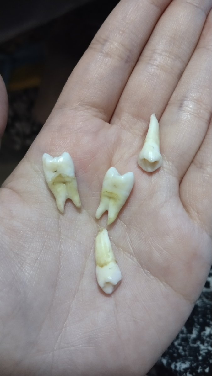 sunkiassed's tweet photo. wts gigi premolar sehat atas &amp; bawah. tawar sampe sama sama enak. lagi bu!

jogja https://t.co/EAHS8uBkCj