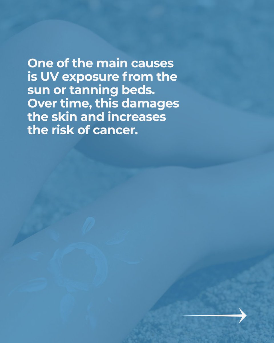 DermaSensor's tweet photo. Skin cancer risk accumulates over years, and many changes go unnoticed until it's too late. Nearly 9,500 people in the U.S. are diagnosed daily. 

Stay ahead: find a DermaSensor™ physician: https://t.co/dwaRRg8FJx https://t.co/aGHQaFSs9E