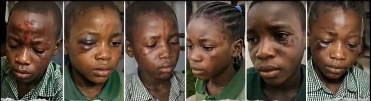 offme__01's tweet photo. Kids going through pains that can actually make me cry in silent like a baby on their happy day as they said💔 https://t.co/cACEGvO1No