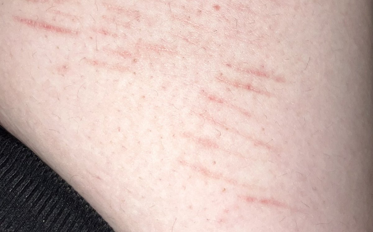 r1ddlem4n's tweet photo. I love these scars lowkey
I’m shit posting rn idgaf…. https://t.co/hoSFWlxEP9
