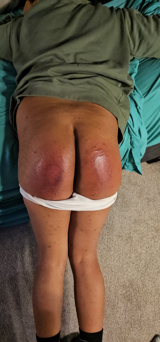 switch0699's tweet photo. Hardest spanking i got last year with the hairbrush and bathbrush https://t.co/xpbsP3zS99