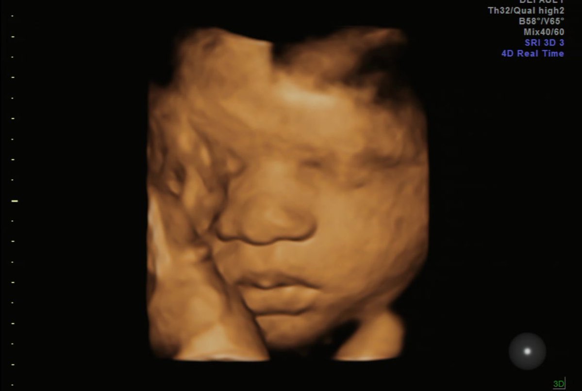 MyNamesNi's tweet photo. Hii mommy baby🥹🩵🩵 I love all the pictures I got of you today ☺️☺️ ur soooo handsome !!! I can’t wait to meet you 41 days to go my love bug ☺️☺️ https://t.co/7TmC1kUPgH