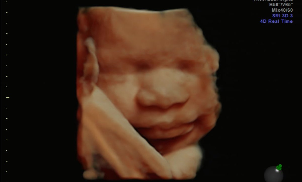 MyNamesNi's tweet photo. Hii mommy baby🥹🩵🩵 I love all the pictures I got of you today ☺️☺️ ur soooo handsome !!! I can’t wait to meet you 41 days to go my love bug ☺️☺️ https://t.co/7TmC1kUPgH
