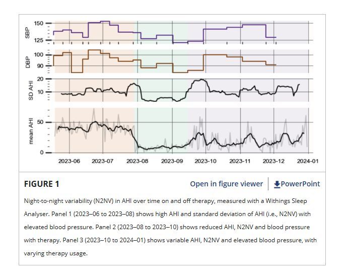 RespirologyAPSR's tweet photo. 🗨️ COMMENTARY: New Obstructive Sleep Apnoea Multi-Night Diagnostic Devices. Is a Single Night of Measurement Now Considered Enough? 
https://t.co/Nv5cWTlXv3 https://t.co/dELrUWHRtd