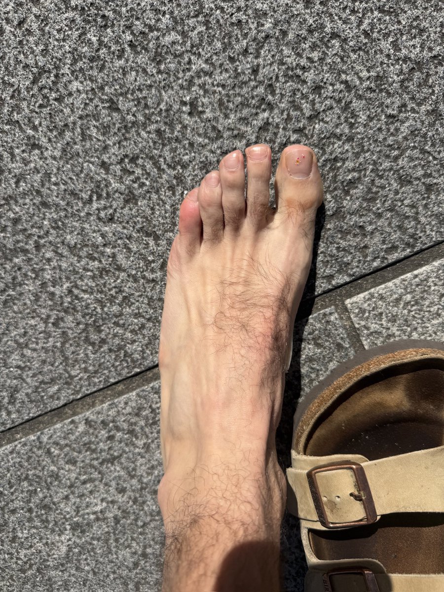 jpralston15's tweet photo. @Brady_H Brady I wore these in Tokyo and ended up developing the worst blister of my life on my left foot. Mostly due to juking through crowds. I’ve had great success with the saucony endorphin elite at London and Boston. https://t.co/lJk3jsSldm